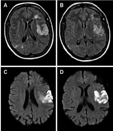 Figure 1. Reticular livedo on limbs.