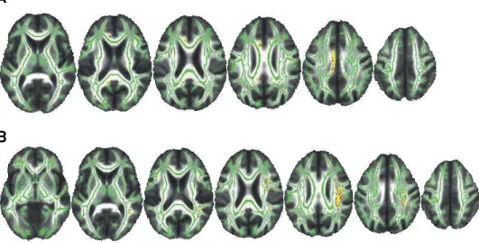 Figure 1. Correlation between white matter integrity and memory in whole-brain analyses.