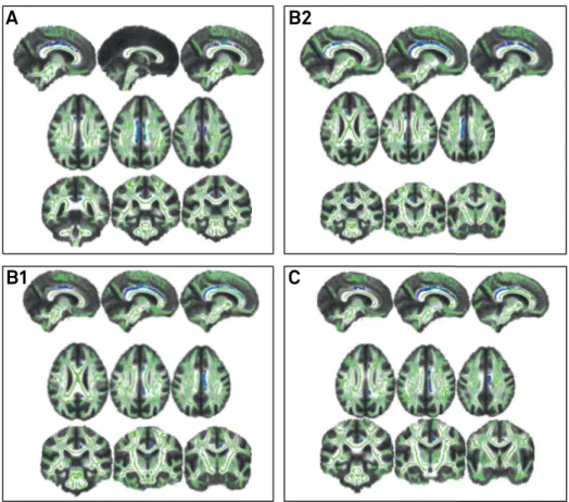 Figure 3. Correlation between mean diffusivity and memory in region of interest analyses.