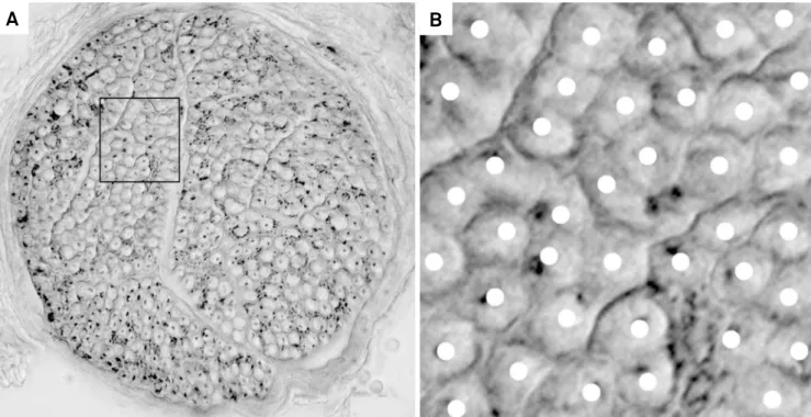 Figure 5. Microphotography of an intercostobrachial nerve section (a), showing the fibers and a selection area (b) to exemplify the  fiber counting for the histomorphometric analysis (From the authors archive).