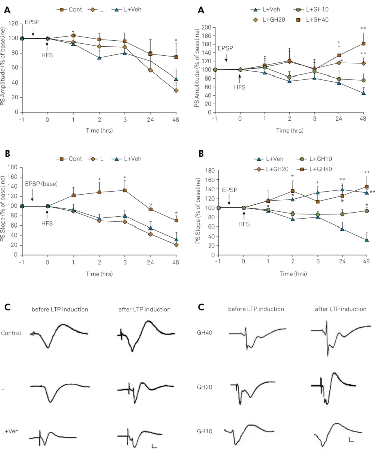 Figure 2. (A) Effects of bilateral nucleus basalis magnocellularis  lesion with ibotenic acid injection (L), bilateral nucleus 