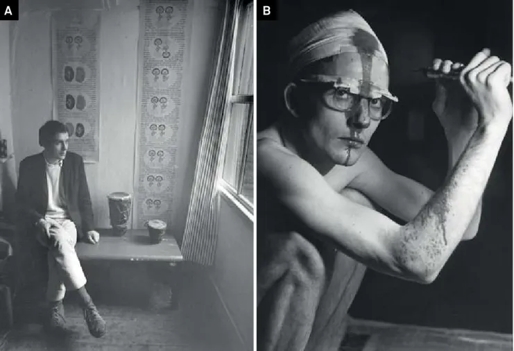 Figure 1. Hugo Bart Huges: a. Huges and his scroll. b. Self-trepanation. Photos by Cor Jaring (www.madscientistblog.ca/mad- (www.madscientistblog.ca/mad-scientist-6-bart-buges/#sthash.JNSVuOjN.dpbs).