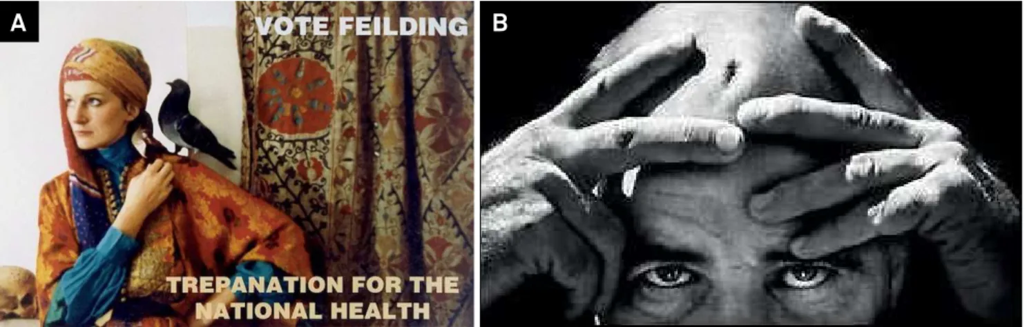 Figure 3. Amanda Feilding and Paul Halvorson. a. Amanda Feilding’s campaign poster. (www.vice.com/read/meet-the-man-who- (www.vice.com/read/meet-the-man-who-drilled-a-hole-in-his-own-skull-to-stay-high-forever.) b