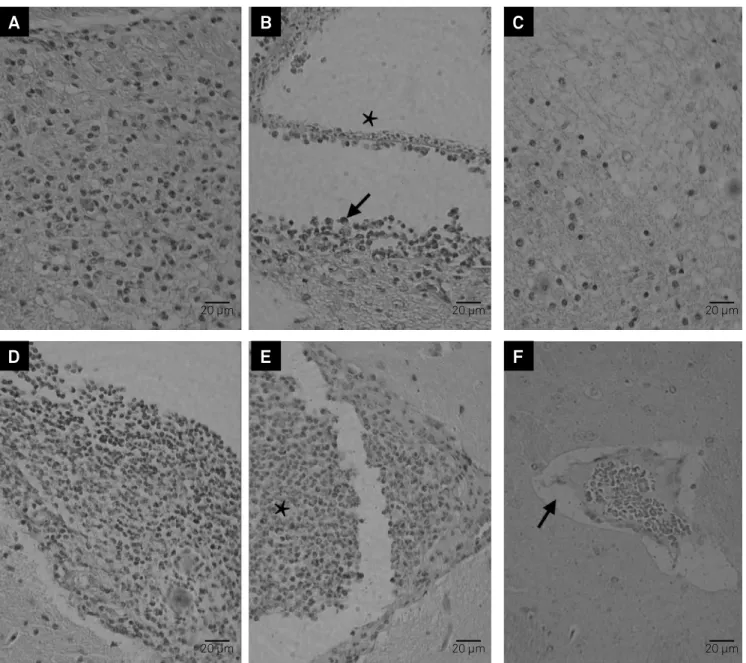 Figure 2. Microscopic alterations in encephala of intracranial infected BALB/c WT and BALB/c IL-4-KO mice