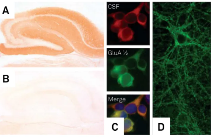 Figure 3. Techniques for the detection of anti-neuronal  antibodies. Indirect immunohistochemistry on rat brain tissue  with a serum of a patient with anti-NMDAR encephalitis  shows strong labeling of hippocampal neurons (A) whereas a  serum of a healthy i