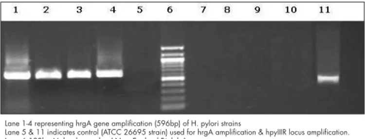 FIGURE  4. Gel  photograph  showing  amplification  of  the  hgrA  and  hpyIIIR Status in H