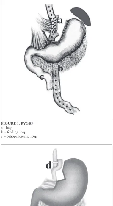 FIGURE 1. RYGBP  a - bag 