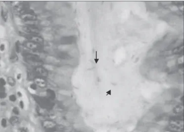 FIGURE  1.  Detection  of  Helicobacter  pylori  in  histological  tissues  was  performed by Giemsa (400×), arrows