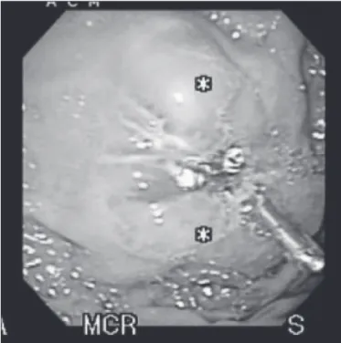 FIGURE 1C. After excision of the lesion