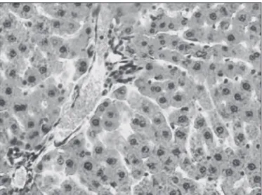 FIGURE 2. Histopathological section of liver tissue from rat 9, Group  II, showing macrovesicular steatosis grade 1 (H-E; 400X)