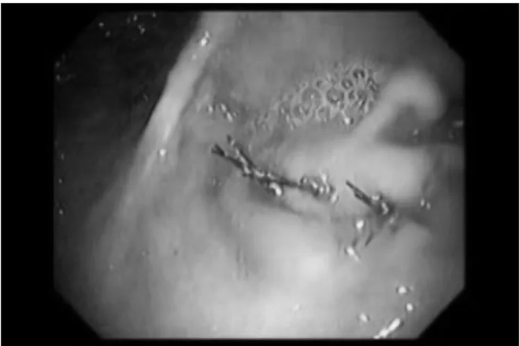 FIGURE  7.  The  histology  shows  complete  restoration  of  the mucosal lining.