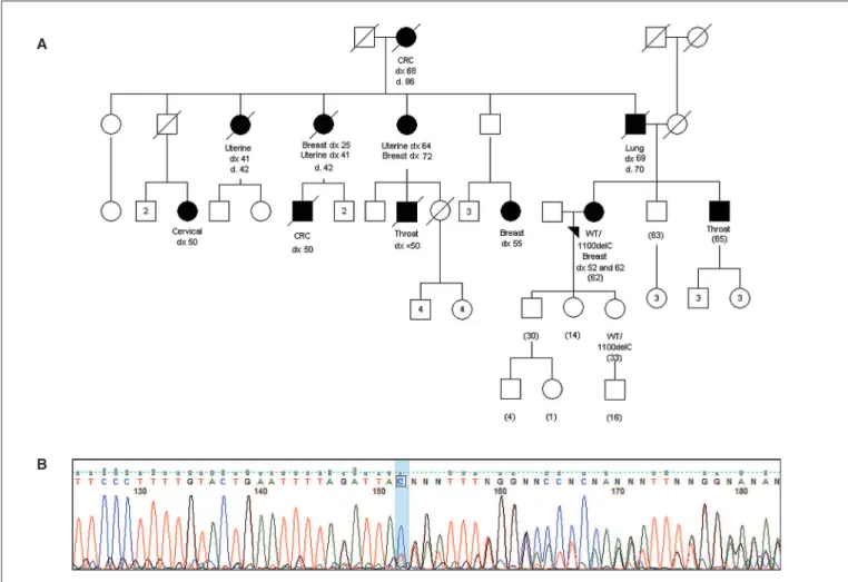 FIGURE 3. A. Pedigree of the patient identiied as  CHEK2  1100delC mutation carrier. Cancer-affected individuals are shown in blackened symbols