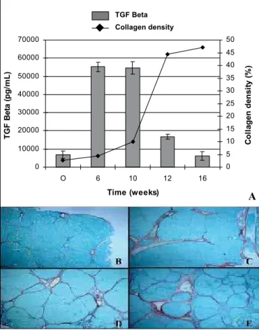 FIGURE 1 . A) Mean levels of serum TGF  β 1 (ng/mL) and collagen den- den-sity (%) at different times of Carbon Tetrachloride exposition