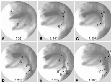 FIGURE 2. Sequence of 8.5 seconds from frames (f.) 35 to 290 obtained  from dysphagic PD patient with resting tremor and without rigidity