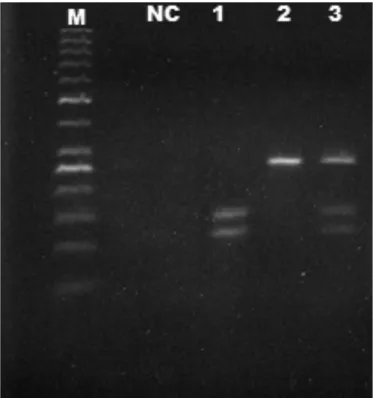 FIGURE 1. Electrophoretic proiles corresponding to homozigous geno- geno-types GG (1) and AA (2) and heterozygous genotype AG (3) of the SNP  T300A of the gene  ATG16L1 
