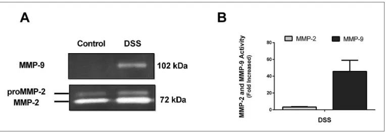FIGURE 3. A representative zymogram of matrix metalloproteinases in the colon of the DSS-induced colitis model.