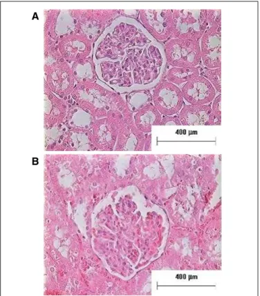 FIGURE 1. Representative micrographs of the renal slices (hematoxylin  and eosin) from bile duct ligated (BDL) and sham operated (control) rats