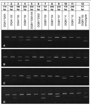 FIGURE 2. Eletrophoresis gel to classiication of HLA alleles. Internal  control with 796bp