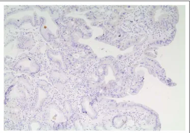 FIGURE 2. Microscopy of a HER2-positive tumor sample.