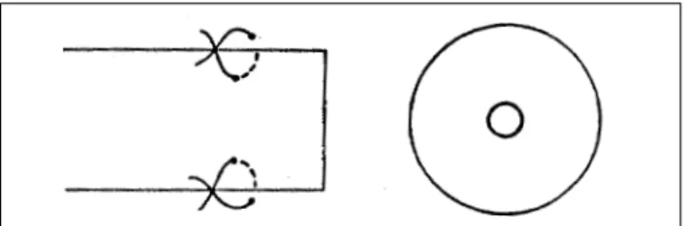 Fig. 1 - The author's operation for shortening the arc of contact.