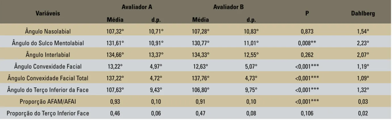 TABELA 2 - Avaliação do erro interexaminadores das variáveis da análise facial numérica do perfil.Nota: o valor de p refere-se ao teste t de Student para amostras 