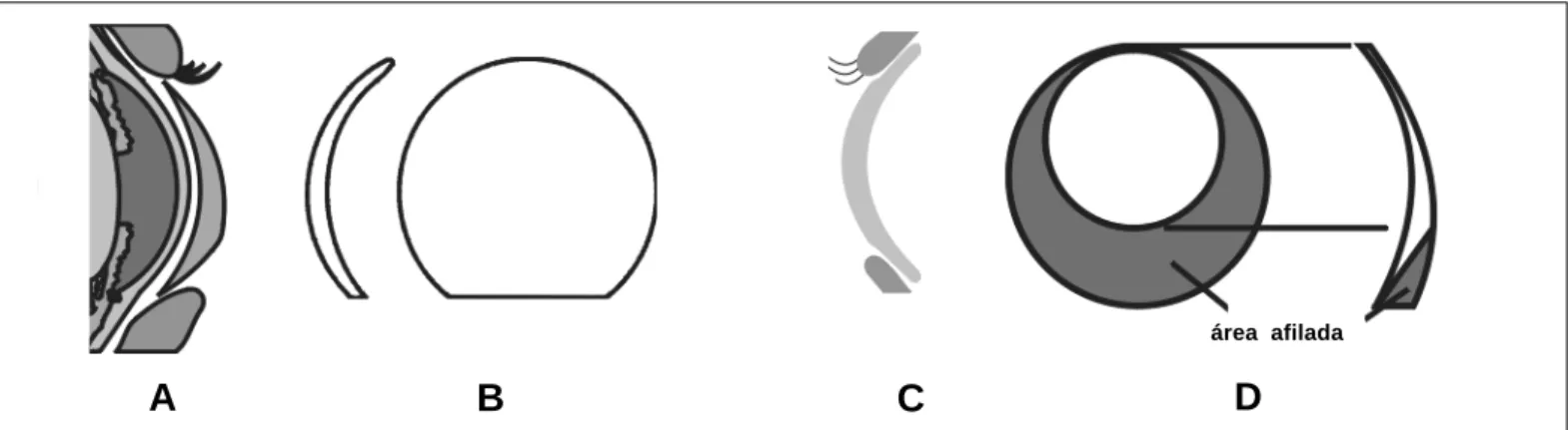 Figura 1 - Desenhos de lentes de contato: A) com prisma de lastro; B) truncada; C) com bordas chanfradas (perfil); D) com lenticulação excêntricaárea afilada