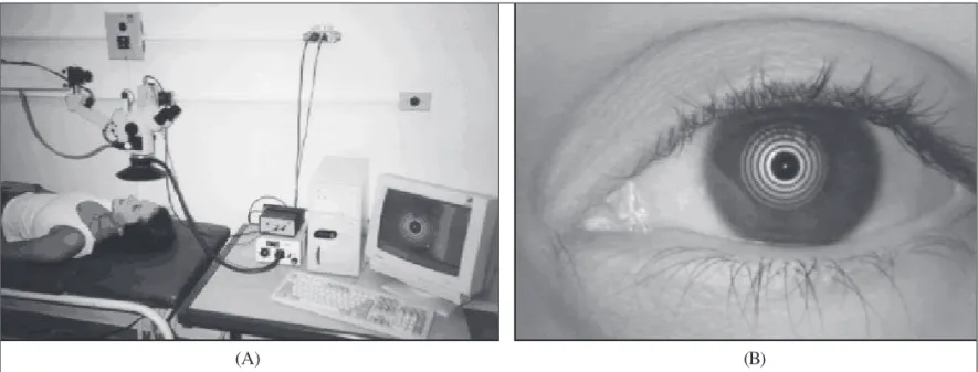Figure 1 - (A) Complete system mounted in our laboratory for preliminary tests prior to installation in the surgery room