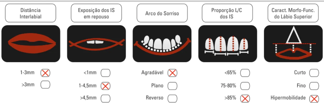 FIGURA 24 - Aspectos avaliados no checklist: A) exposição dos incisivos superiores em repouso; B) distância interlabial em  repouso e características morfológicas do lábio superior; C) arco do sorriso e características funcionais do lábio superior; 