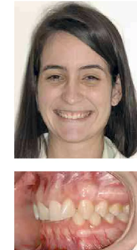FIGURA 29 - Caso clínico 3 - aspectos faciais e dentários iniciais.