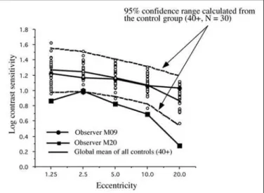 Figure 6 - Individual 16Hz Cree data compared with a 95% confidence interval calculated with all the controls over 40 years of age