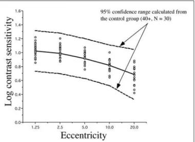 Figure 7 - Individual 2Hz Parkinson data compared with a 95% con- con-fidence interval calculated with all the controls over 40 years of age