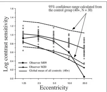 Figure 5 - Individual 2Hz Cree data compared with a 95% confidence interval calculated with all the controls over 40 years of age