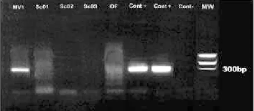 Figure 1 - PCR-amplified products from clinical samples. Swabs samples from patients with keratoconjunctivitis were tested by PCR.