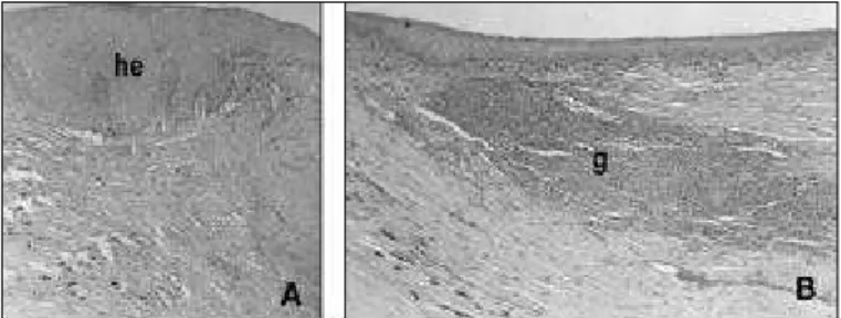 Figure 2 - Representative histopathological changes of the lamellar scleral grafts. (A) Hyperplasic conjunctival epithelium (he) on the 15 th after surgery (H&amp;E, x 100)