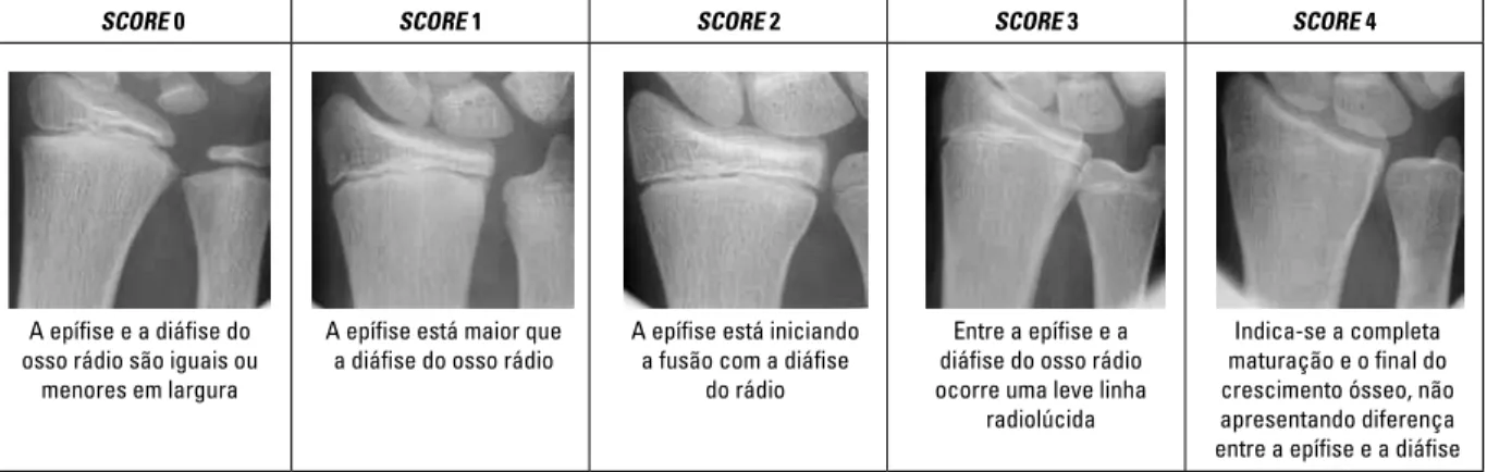 FIGURA 1 - Exemplos de radiografias do osso rádio com seus respectivos scores.