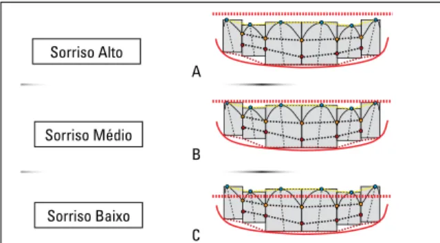 FIGURA 17 - Sorriso Alto (A); Sorriso Médio (B) e Sorriso Baixo (C).ASorriso AltoBSorriso MédioCSorriso Baixo