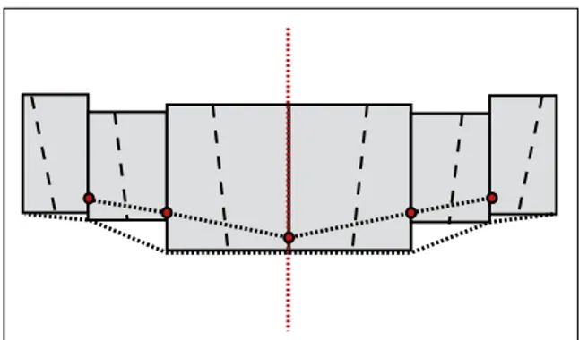 FIGURA 10 - Linha dos pontos de contato. Essa linha deve guardar um  certo paralelismo com a linha incisal.
