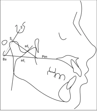 FIGURA 1 - Medidas da nasofaringe.