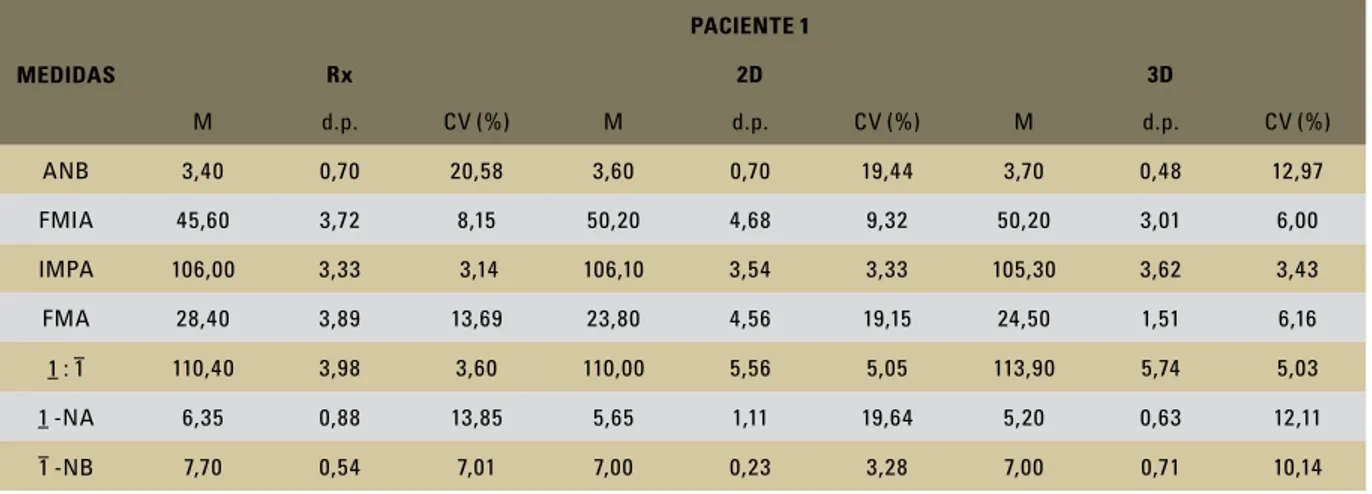 TABELA 1 - Valores das médias aritméticas (M), dos desvios-padrão (d.p.) e dos coeficientes de variância (CV) das variáveis medidas na radiografia  cefalométrica lateral (Rx) e nas imagens da TC em 2D e 3D do paciente 1.