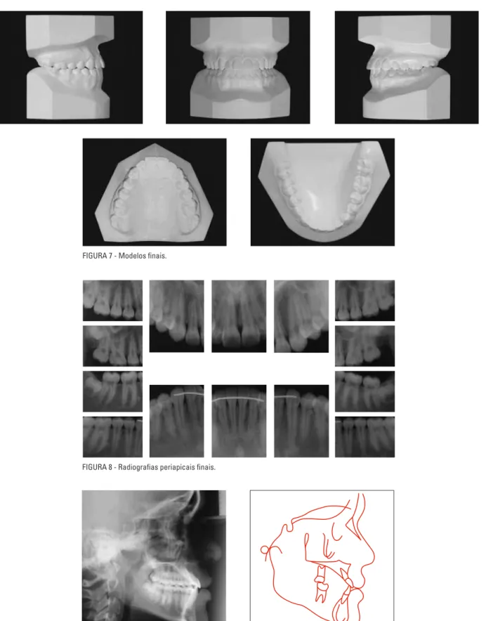 FIGURA 8 - Radiografias periapicais finais.