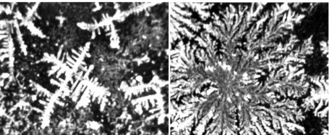 Figure 3. Tear crystallization test in patients with dry eye (left) and in normal volunteers (right)
