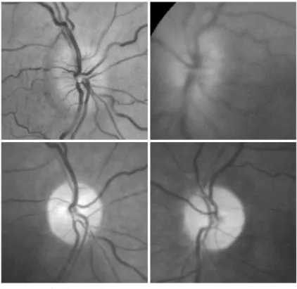 Figure 1.  Fundus photograph.