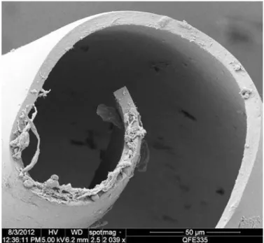 Figure 7. Scanning electron microscopy of DMEK graft with residual folds at endothelial/