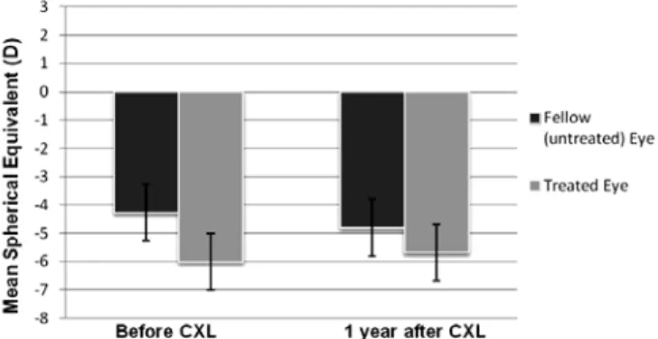 Figure 1. Average spherical equivalent before and one year after corneal collagen  cross-linking with ultraviolet-A irradiation and hypo-osmolar ribolavin solution