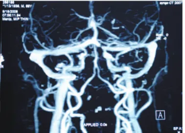 Figure 2. Retinography of the left eye showing uremarkable fundoscopy of the left eye.