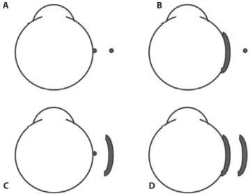 Figure 6. Schematic representation of the possible relative sizes of the elements of a  magnetic circuit adapted to introduce forces to the oculomotor system
