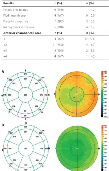 Figure 1. A) Pachymetry map before the start of the treatment. B) Pachymetry map 15  days after the start of the treatment.