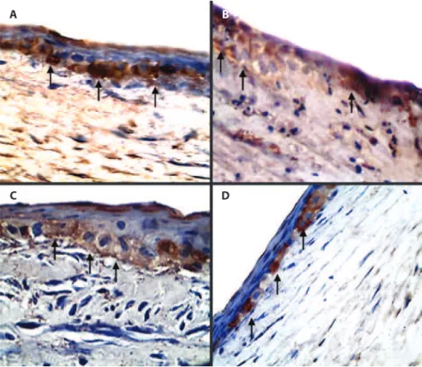 Figure 3. Photomicrographs of corneas from male, adult, New Zealand White rabbits in group nalbuphine (GN)  (B and D) and group control (GC) (A and C) 1 (A and B) and 9 (C and D) days after lamellar keratectomy
