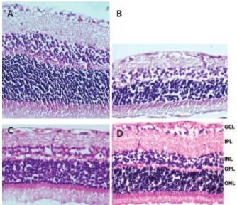 Figure 4. Representative photographs of TUNEL staining of rat retinas in control (A),  ischemic (B), solvent (C), and quercetin (D) groups
