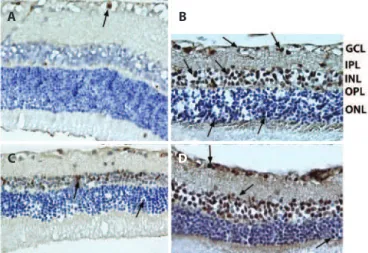 Figure 6. Representative photographs of caspase-3 (+) cells. A) Control group; B) Is- Is-chemic group; C) Solvent group, and D) Quercetin group